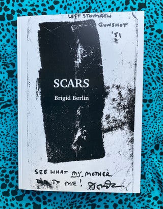 SCARS. Brigid Berlin.